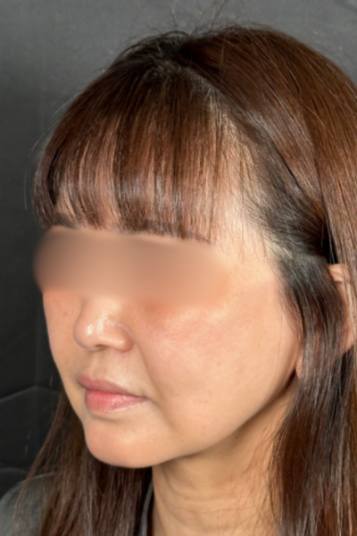 Postoperative Condition Part 1