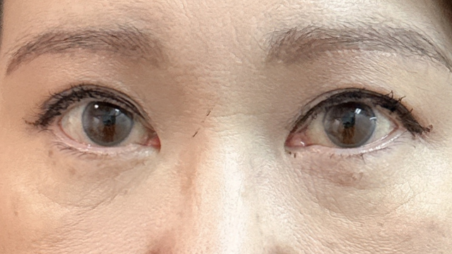 Postoperative Condition Part 1