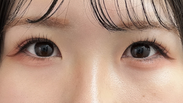 Postoperative Condition Part 1