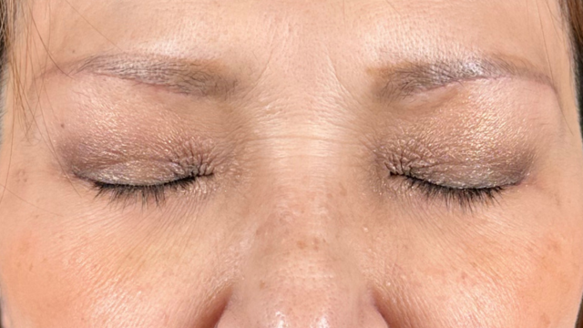 Postoperative Condition Part 1