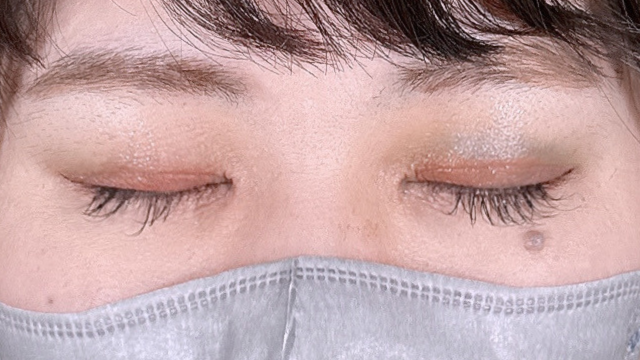 Postoperative Condition Part 1