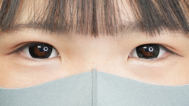 Postoperative Condition Part 1