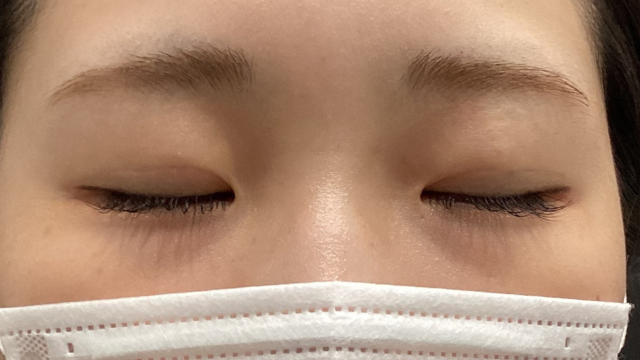 Postoperative Condition Part 1