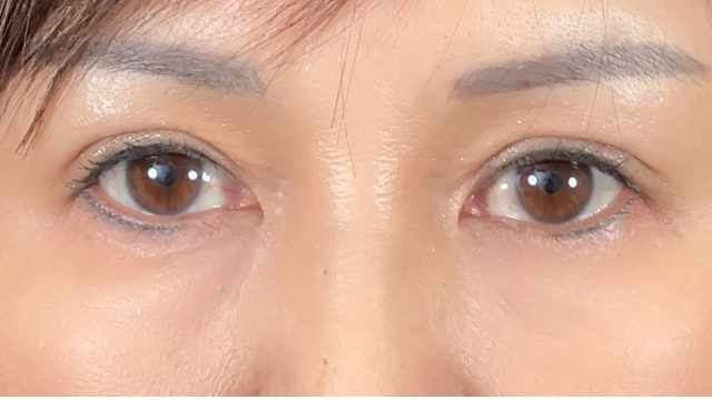 Postoperative Condition Part 1