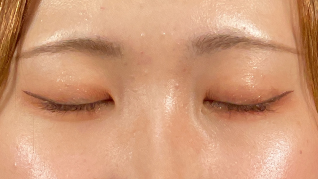 Postoperative Condition Part 1