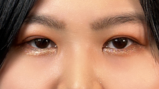 Postoperative Condition Part 1