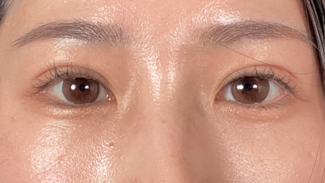 Postoperative Condition Part 1