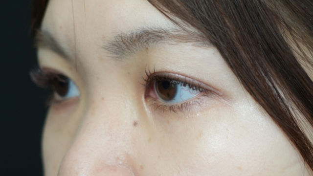 Postoperative Condition Part 1