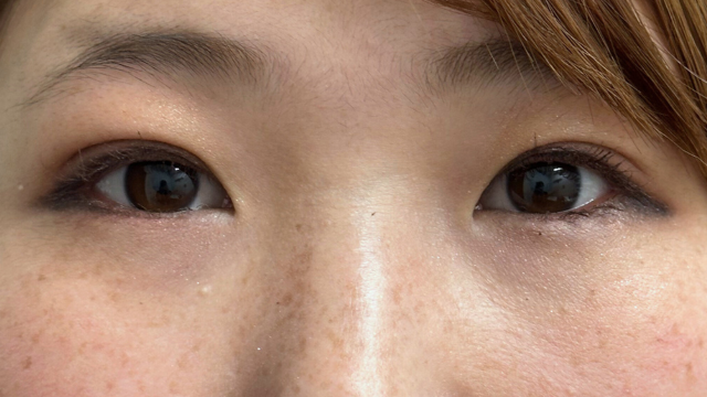 Postoperative Condition Part 1