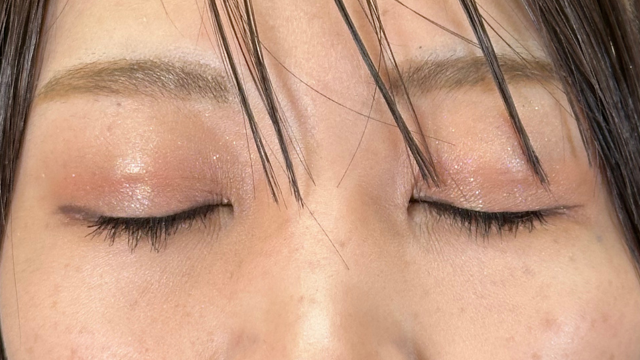 Postoperative Condition Part 1