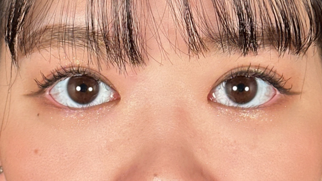 Postoperative Condition Part 1