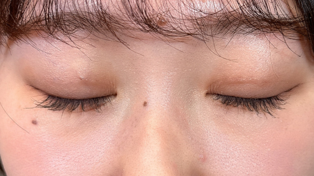 Postoperative Condition Part 1