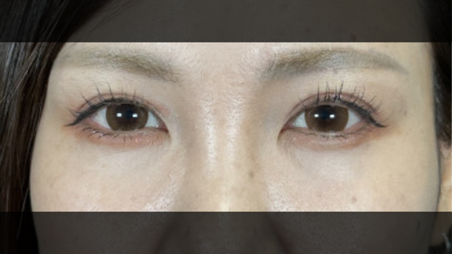 Postoperative Condition Part 1