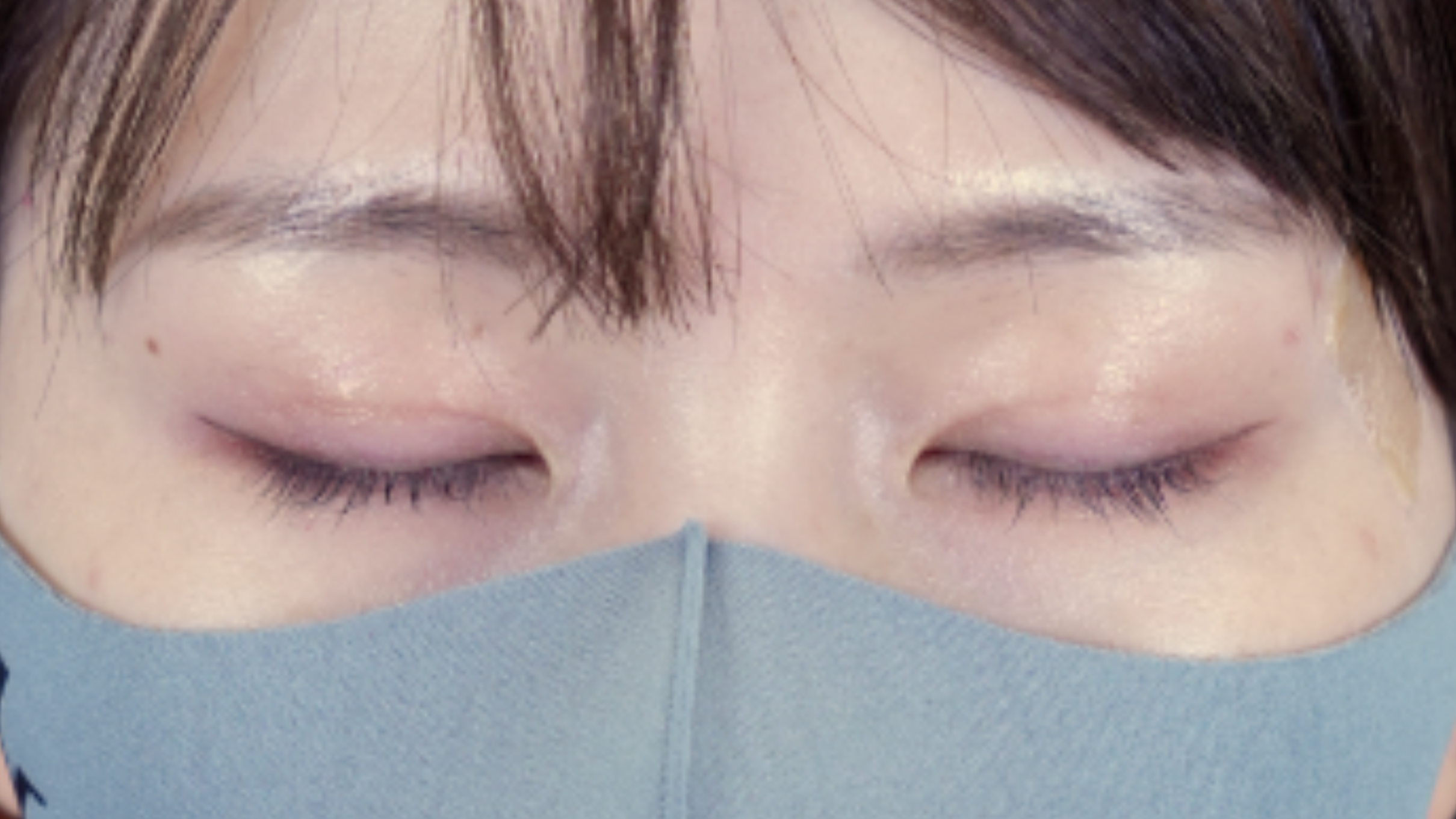 Postoperative Condition Part 1