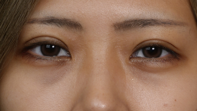 Postoperative Condition Part 1