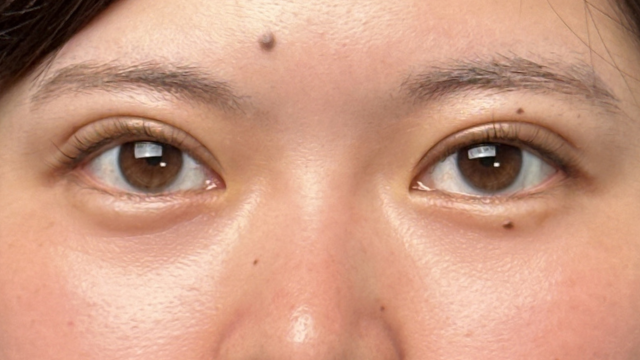 Postoperative Condition Part 1