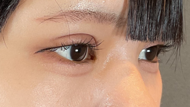 Postoperative Condition Part 1