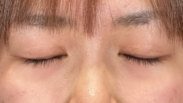 Postoperative Condition Part 1