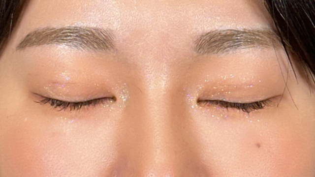 Postoperative Condition Part 1