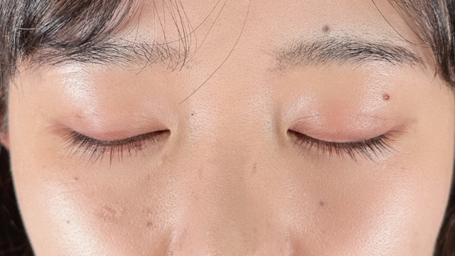 Postoperative Condition Part 1