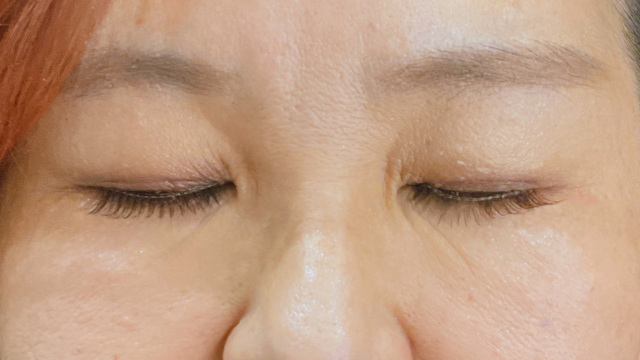 Postoperative Condition Part 1