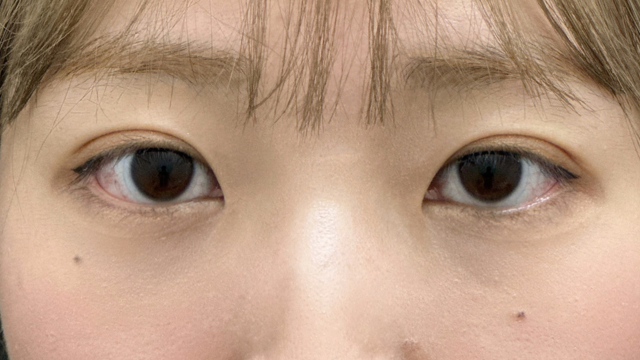 Postoperative Condition Part 1