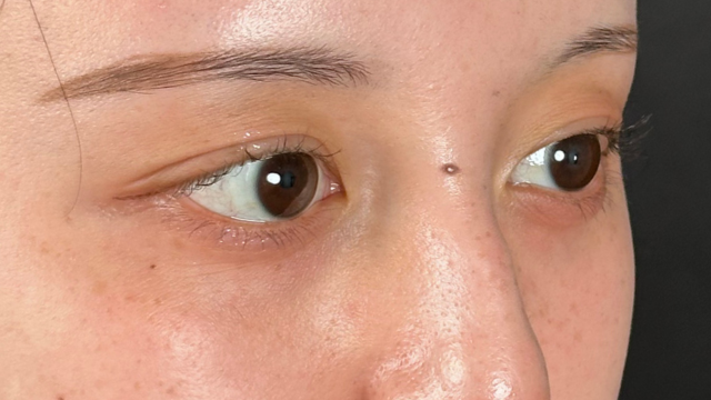 Postoperative Condition Part 1