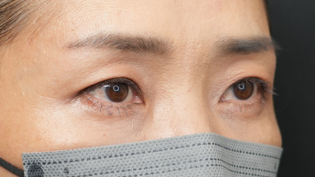 Postoperative Condition Part 1