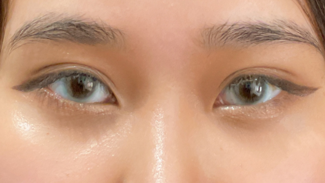 Postoperative Condition Part 1