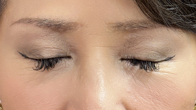 Postoperative Condition Part 1