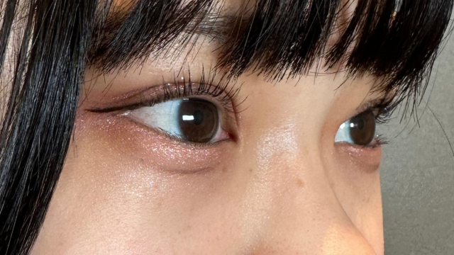 Postoperative Condition Part 1