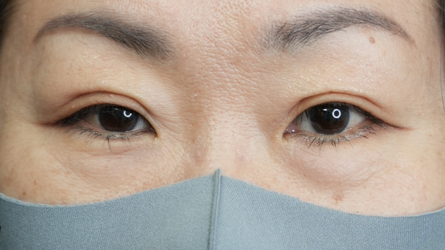 Postoperative Condition Part 1