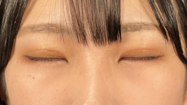 Postoperative Condition Part 1