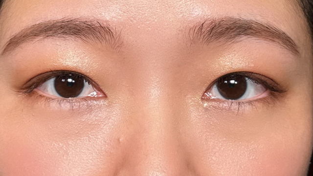 Postoperative Condition Part 1