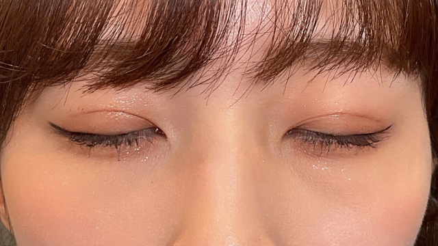 Postoperative Condition Part 1