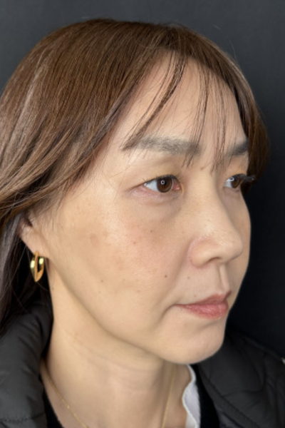 Postoperative Condition Part 1