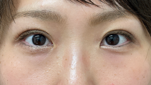 Postoperative Condition Part 1