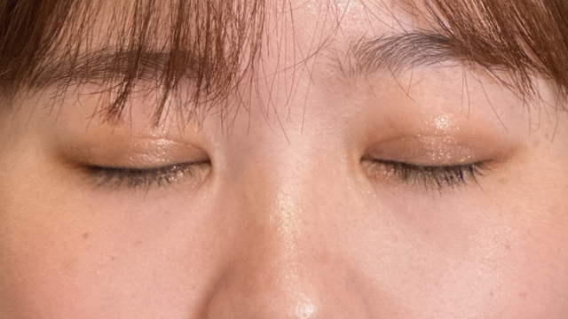 Postoperative Condition Part 1