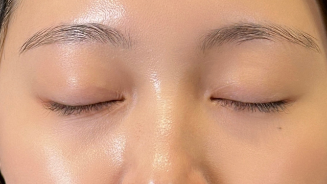 Postoperative Condition Part 1