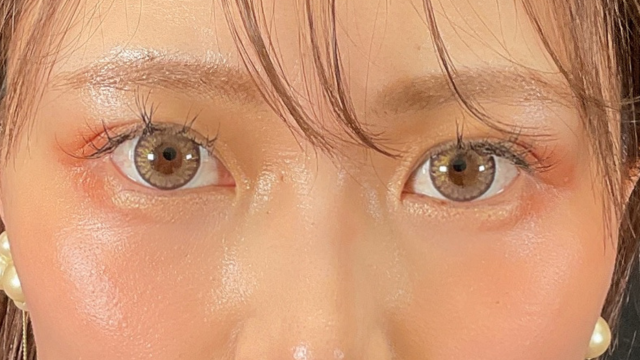 Postoperative Condition Part 1