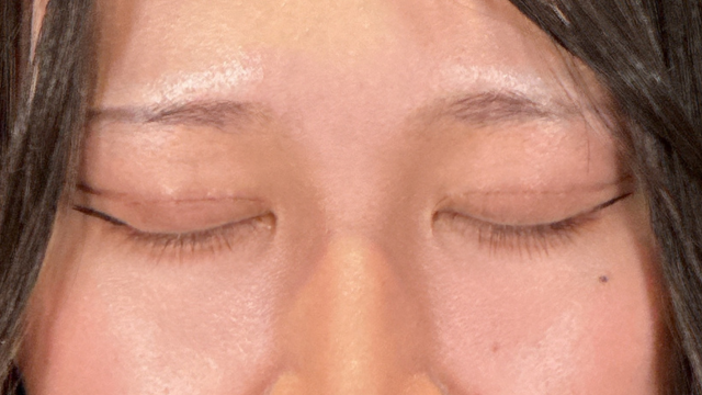 Postoperative Condition Part 1