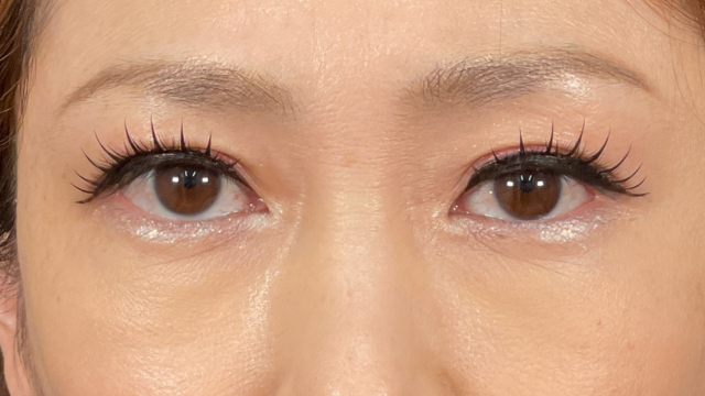 Postoperative Condition Part 1