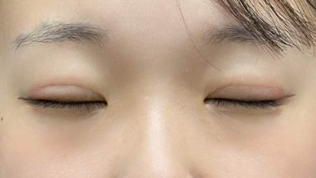 Postoperative Condition Part 1