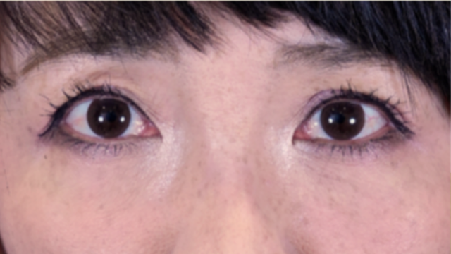 Postoperative Condition Part 1