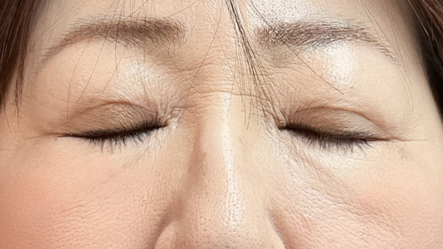 Postoperative Condition Part 1