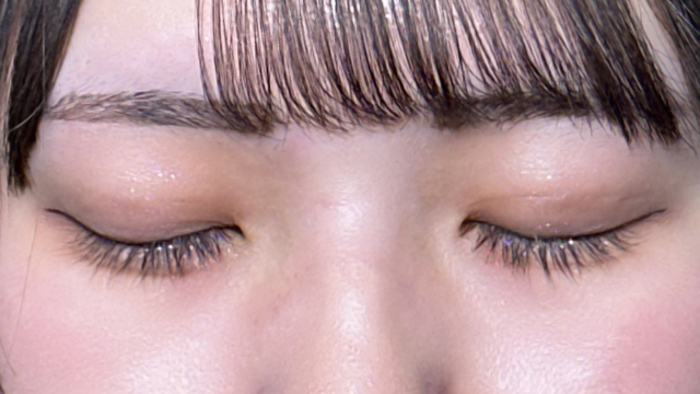 Postoperative Condition Part 1