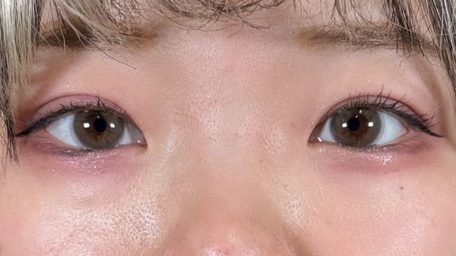 Postoperative Condition Part 1