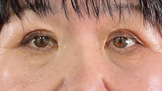 Postoperative Condition Part 1