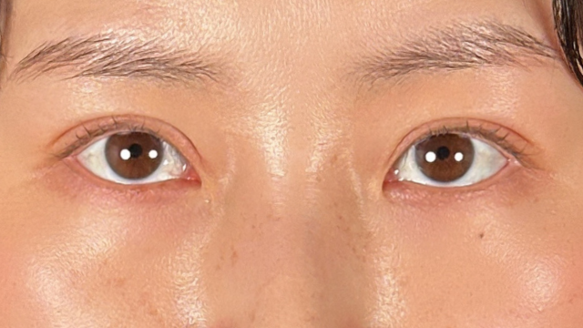 Postoperative Condition Part 1