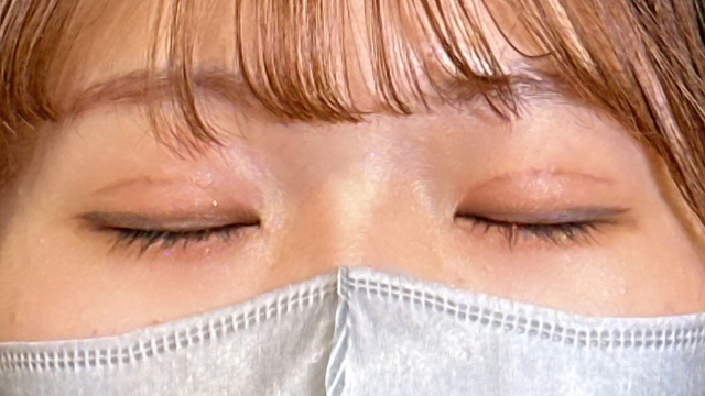 Postoperative Condition Part 1